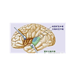 诊断耳蜗死区的重要性是什么？