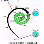 如何识别或鉴定耳蜗死区？